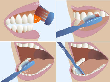 как правильно чистить зубы схема