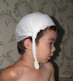 Рваная рана на голове у ребёнка. Первая помощь в домашних условиях